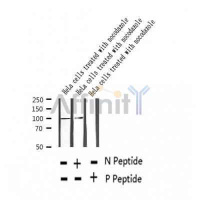 AF2362 at 1/100 staining Mouse lung tissue by IHC-P. The sample was formaldehyde fixed and a heat mediated antigen retrieval step in citrate buffer was performed. The sample was then blocked and incubated with the antibody for 1.5 hours at 22¡ãC. An HRP conjugated goat anti-rabbit antibody was used as the secondary