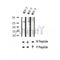 AF2365 at 1/100 staining Human thyroid cancer tissue by IHC-P. The sample was formaldehyde fixed and a heat mediated antigen retrieval step in citrate buffer was performed. The sample was then blocked and incubated with the antibody for 1.5 hours at 22¡ãC. An HRP conjugated goat anti-rabbit antibody was used as the secondary