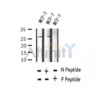 AF2365 at 1/100 staining Human thyroid cancer tissue by IHC-P. The sample was formaldehyde fixed and a heat mediated antigen retrieval step in citrate buffer was performed. The sample was then blocked and incubated with the antibody for 1.5 hours at 22¡ãC. An HRP conjugated goat anti-rabbit antibody was used as the secondary