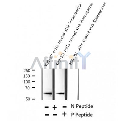 AF2367 at 1/100 staining Mouse lung tissue by IHC-P. The sample was formaldehyde fixed and a heat mediated antigen retrieval step in citrate buffer was performed. The sample was then blocked and incubated with the antibody for 1.5 hours at 22¡ãC. An HRP conjugated goat anti-rabbit antibody was used as the secondary