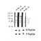 AF2370 at 1/100 staining Human thyroid cancer tissue by IHC-P. The sample was formaldehyde fixed and a heat mediated antigen retrieval step in citrate buffer was performed. The sample was then blocked and incubated with the antibody for 1.5 hours at 22¡ãC. An HRP conjugated goat anti-rabbit antibody was used as the secondary