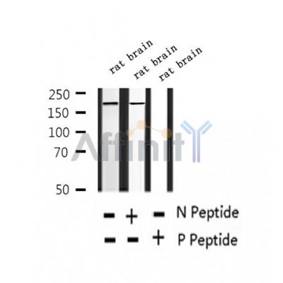 AF2371 at 1/100 staining Human thyroid cancer tissue by IHC-P. The sample was formaldehyde fixed and a heat mediated antigen retrieval step in citrate buffer was performed. The sample was then blocked and incubated with the antibody for 1.5 hours at 22¡ãC. An HRP conjugated goat anti-rabbit antibody was used as the secondary