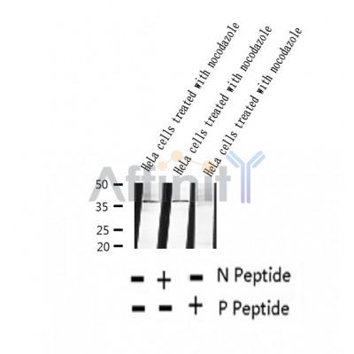 AF2372 at 1/100 staining Rat liver tissue by IHC-P. The sample was formaldehyde fixed and a heat mediated antigen retrieval step in citrate buffer was performed. The sample was then blocked and incubated with the antibody for 1.5 hours at 22¡ãC. An HRP conjugated goat anti-rabbit antibody was used as the secondary