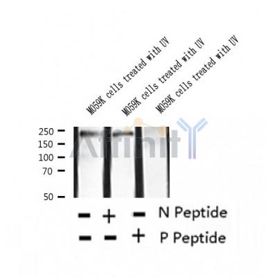 AF2373 at 1/100 staining Human lung tissue by IHC-P. The sample was formaldehyde fixed and a heat mediated antigen retrieval step in citrate buffer was performed. The sample was then blocked and incubated with the antibody for 1.5 hours at 22¡ãC. An HRP conjugated goat anti-rabbit antibody was used as the secondary