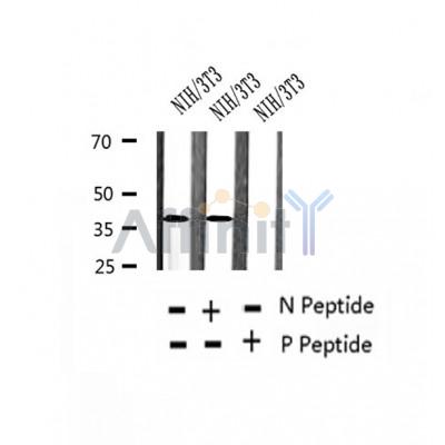 AF2375 at 1/100 staining Human thyroid cancer tissue by IHC-P. The sample was formaldehyde fixed and a heat mediated antigen retrieval step in citrate buffer was performed. The sample was then blocked and incubated with the antibody for 1.5 hours at 22¡ãC. An HRP conjugated goat anti-rabbit antibody was used as the secondary