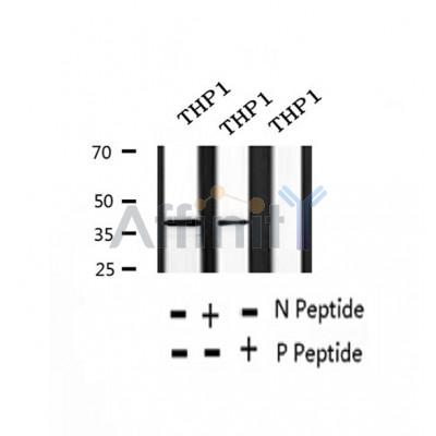 AF2376 at 1/100 staining Human thyroid cancer tissue by IHC-P. The sample was formaldehyde fixed and a heat mediated antigen retrieval step in citrate buffer was performed. The sample was then blocked and incubated with the antibody for 1.5 hours at 22¡ãC. An HRP conjugated goat anti-rabbit antibody was used as the secondary