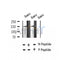AF2384 at 1/100 staining Human thyroid cancer tissue by IHC-P. The sample was formaldehyde fixed and a heat mediated antigen retrieval step in citrate buffer was performed. The sample was then blocked and incubated with the antibody for 1.5 hours at 22¡ãC. An HRP conjugated goat anti-rabbit antibody was used as the secondary