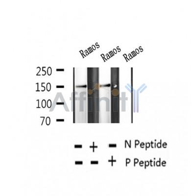 AF2384 at 1/100 staining Human thyroid cancer tissue by IHC-P. The sample was formaldehyde fixed and a heat mediated antigen retrieval step in citrate buffer was performed. The sample was then blocked and incubated with the antibody for 1.5 hours at 22¡ãC. An HRP conjugated goat anti-rabbit antibody was used as the secondary