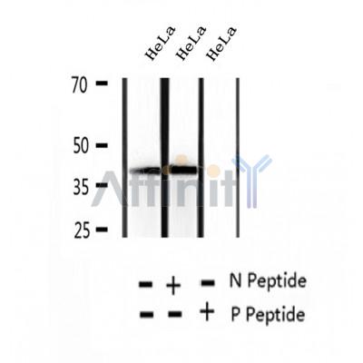 AF2386 at 1/100 staining Human thyroid cancer tissue by IHC-P. The sample was formaldehyde fixed and a heat mediated antigen retrieval step in citrate buffer was performed. The sample was then blocked and incubated with the antibody for 1.5 hours at 22¡ãC. An HRP conjugated goat anti-rabbit antibody was used as the secondary