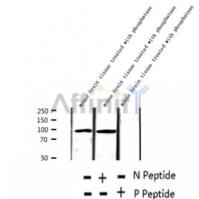 AF2390 at 1/100 staining Human thyroid cancer tissue by IHC-P. The sample was formaldehyde fixed and a heat mediated antigen retrieval step in citrate buffer was performed. The sample was then blocked and incubated with the antibody for 1.5 hours at 22¡ãC. An HRP conjugated goat anti-rabbit antibody was used as the secondary
