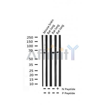 AF3391 staining HeLa by IF/ICC. The sample were fixed with PFA and permeabilized in 0.1% Triton X-100,then blocked in 10% serum for 45 minutes at 25¡ãC. The primary antibody was diluted at 1/200 and incubated with the sample for 1 hour at 37¡ãC. An  Alexa Fluor 594 conjugated goat anti-rabbit IgG (H+L) Ab, diluted at 1/600, was used as the secondary antibod
