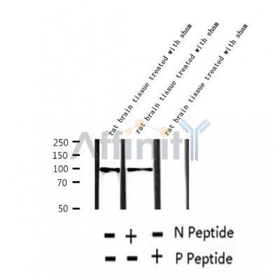 AF2391 at 1/100 staining Human thyroid cancer tissue by IHC-P. The sample was formaldehyde fixed and a heat mediated antigen retrieval step in citrate buffer was performed. The sample was then blocked and incubated with the antibody for 1.5 hours at 22¡ãC. An HRP conjugated goat anti-rabbit antibody was used as the secondary