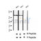 AF2393 at 1/100 staining Human thyroid cancer tissue by IHC-P. The sample was formaldehyde fixed and a heat mediated antigen retrieval step in citrate buffer was performed. The sample was then blocked and incubated with the antibody for 1.5 hours at 22¡ãC. An HRP conjugated goat anti-rabbit antibody was used as the secondary