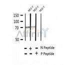 AF2394 at 1/100 staining Human breast cancer tissue by IHC-P. The sample was formaldehyde fixed and a heat mediated antigen retrieval step in citrate buffer was performed. The sample was then blocked and incubated with the antibody for 1.5 hours at 22¡ãC. An HRP conjugated goat anti-rabbit antibody was used as the secondary