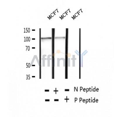 AF2395 at 1/100 staining Human lung tissue by IHC-P. The sample was formaldehyde fixed and a heat mediated antigen retrieval step in citrate buffer was performed. The sample was then blocked and incubated with the antibody for 1.5 hours at 22¡ãC. An HRP conjugated goat anti-rabbit antibody was used as the secondary
