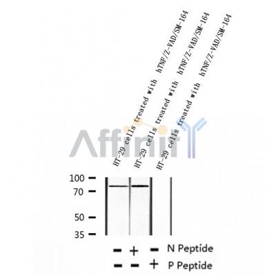 AF2398 at 1/100 staining Human thyroid cancer tissue by IHC-P. The sample was formaldehyde fixed and a heat mediated antigen retrieval step in citrate buffer was performed. The sample was then blocked and incubated with the antibody for 1.5 hours at 22¡ãC. An HRP conjugated goat anti-rabbit antibody was used as the secondary