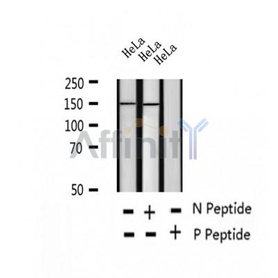 AF2401 at 1/100 staining Mouse kidney tissue by IHC-P. The sample was formaldehyde fixed and a heat mediated antigen retrieval step in citrate buffer was performed. The sample was then blocked and incubated with the antibody for 1.5 hours at 22¡ãC. An HRP conjugated goat anti-rabbit antibody was used as the secondary