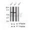 AF2402 at 1/100 staining Human thyroid cancer tissue by IHC-P. The sample was formaldehyde fixed and a heat mediated antigen retrieval step in citrate buffer was performed. The sample was then blocked and incubated with the antibody for 1.5 hours at 22¡ãC. An HRP conjugated goat anti-rabbit antibody was used as the secondary