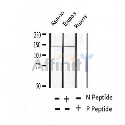 AF2403 at 1/100 staining Human thyroid cancer tissue by IHC-P. The sample was formaldehyde fixed and a heat mediated antigen retrieval step in citrate buffer was performed. The sample was then blocked and incubated with the antibody for 1.5 hours at 22¡ãC. An HRP conjugated goat anti-rabbit antibody was used as the secondary