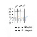 AF2404 at 1/100 staining Human thyroid cancer tissue by IHC-P. The sample was formaldehyde fixed and a heat mediated antigen retrieval step in citrate buffer was performed. The sample was then blocked and incubated with the antibody for 1.5 hours at 22¡ãC. An HRP conjugated goat anti-rabbit antibody was used as the secondary