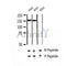 AF2405 at 1/100 staining Human thyroid cancer tissue by IHC-P. The sample was formaldehyde fixed and a heat mediated antigen retrieval step in citrate buffer was performed. The sample was then blocked and incubated with the antibody for 1.5 hours at 22¡ãC. An HRP conjugated goat anti-rabbit antibody was used as the secondary
