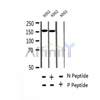 AF2405 at 1/100 staining Human thyroid cancer tissue by IHC-P. The sample was formaldehyde fixed and a heat mediated antigen retrieval step in citrate buffer was performed. The sample was then blocked and incubated with the antibody for 1.5 hours at 22¡ãC. An HRP conjugated goat anti-rabbit antibody was used as the secondary