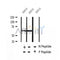 AF2410 at 1/100 staining Human breast cancer tissue by IHC-P. The sample was formaldehyde fixed and a heat mediated antigen retrieval step in citrate buffer was performed. The sample was then blocked and incubated with the antibody for 1.5 hours at 22¡ãC. An HRP conjugated goat anti-rabbit antibody was used as the secondary
