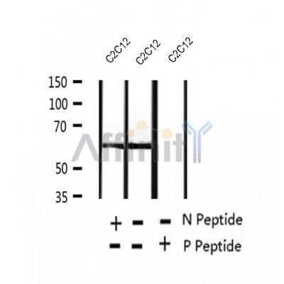 AF2410 at 1/100 staining Human breast cancer tissue by IHC-P. The sample was formaldehyde fixed and a heat mediated antigen retrieval step in citrate buffer was performed. The sample was then blocked and incubated with the antibody for 1.5 hours at 22¡ãC. An HRP conjugated goat anti-rabbit antibody was used as the secondary