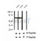 AF2411 at 1/100 staining Human breast cancer tissue by IHC-P. The sample was formaldehyde fixed and a heat mediated antigen retrieval step in citrate buffer was performed. The sample was then blocked and incubated with the antibody for 1.5 hours at 22¡ãC. An HRP conjugated goat anti-rabbit antibody was used as the secondary