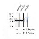 AF2420 at 1/100 staining Human thyroid cancer tissue by IHC-P. The sample was formaldehyde fixed and a heat mediated antigen retrieval step in citrate buffer was performed. The sample was then blocked and incubated with the antibody for 1.5 hours at 22¡ãC. An HRP conjugated goat anti-rabbit antibody was used as the secondary
