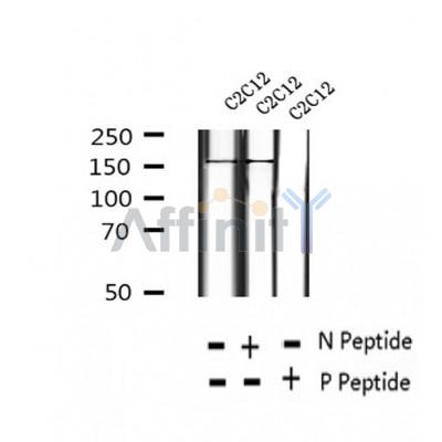 Western blot analysis of extracts of C2C12 cells, using Phospho-TBC1D1 (Ser237) Antibody.