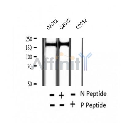 Western blot analysis of extracts of C2C12 cells, using Phospho-TBC1D1 (Thr590) Antibody.