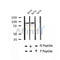 AF2425 at 1/100 staining Human breast cancer tissue by IHC-P. The sample was formaldehyde fixed and a heat mediated antigen retrieval step in citrate buffer was performed. The sample was then blocked and incubated with the antibody for 1.5 hours at 22¡ãC. An HRP conjugated goat anti-rabbit antibody was used as the secondary