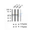 AF2428 at 1/100 staining Human thyroid cancer tissue by IHC-P. The sample was formaldehyde fixed and a heat mediated antigen retrieval step in citrate buffer was performed. The sample was then blocked and incubated with the antibody for 1.5 hours at 22¡ãC. An HRP conjugated goat anti-rabbit antibody was used as the secondary