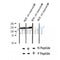 AF2429 at 1/100 staining Human thyroid cancer tissue by IHC-P. The sample was formaldehyde fixed and a heat mediated antigen retrieval step in citrate buffer was performed. The sample was then blocked and incubated with the antibody for 1.5 hours at 22¡ãC. An HRP conjugated goat anti-rabbit antibody was used as the secondary
