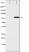 AF3395 staining MDA-MB-435 by IF/ICC. The sample were fixed with PFA and permeabilized in 0.1% Triton X-100,then blocked in 10% serum for 45 minutes at 25¡ãC. The primary antibody was diluted at 1/200 and incubated with the sample for 1 hour at 37¡ãC. An  Alexa Fluor 594 conjugated goat anti-rabbit IgG (H+L) Ab, diluted at 1/600, was used as the secondary antibod