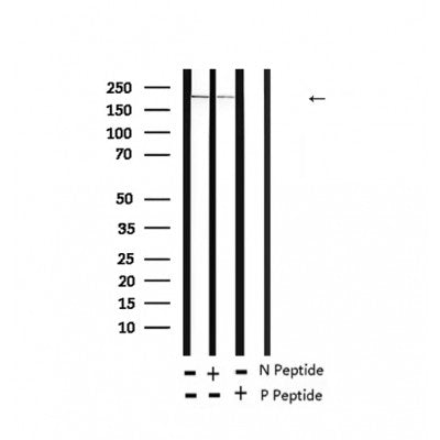 AF2431 at 1/100 staining Human thyroid cancer tissue by IHC-P. The sample was formaldehyde fixed and a heat mediated antigen retrieval step in citrate buffer was performed. The sample was then blocked and incubated with the antibody for 1.5 hours at 22¡ãC. An HRP conjugated goat anti-rabbit antibody was used as the secondary