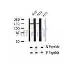 AF2432 at 1/100 staining Human thyroid cancer tissue by IHC-P. The sample was formaldehyde fixed and a heat mediated antigen retrieval step in citrate buffer was performed. The sample was then blocked and incubated with the antibody for 1.5 hours at 22¡ãC. An HRP conjugated goat anti-rabbit antibody was used as the secondary