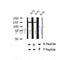 AF2432 at 1/100 staining Human thyroid cancer tissue by IHC-P. The sample was formaldehyde fixed and a heat mediated antigen retrieval step in citrate buffer was performed. The sample was then blocked and incubated with the antibody for 1.5 hours at 22¡ãC. An HRP conjugated goat anti-rabbit antibody was used as the secondary