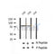 AF2435 at 1/100 staining Rat brain tissue by IHC-P. The sample was formaldehyde fixed and a heat mediated antigen retrieval step in citrate buffer was performed. The sample was then blocked and incubated with the antibody for 1.5 hours at 22¡ãC. An HRP conjugated goat anti-rabbit antibody was used as the secondary