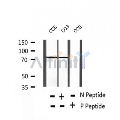 AF2435 at 1/100 staining Rat brain tissue by IHC-P. The sample was formaldehyde fixed and a heat mediated antigen retrieval step in citrate buffer was performed. The sample was then blocked and incubated with the antibody for 1.5 hours at 22¡ãC. An HRP conjugated goat anti-rabbit antibody was used as the secondary