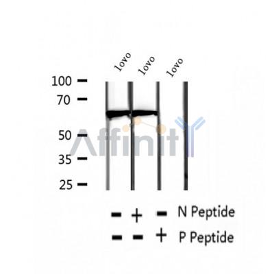 AF2437 at 1/100 staining Rat liver tissue by IHC-P. The sample was formaldehyde fixed and a heat mediated antigen retrieval step in citrate buffer was performed. The sample was then blocked and incubated with the antibody for 1.5 hours at 22¡ãC. An HRP conjugated goat anti-rabbit antibody was used as the secondary