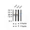 AF2438 at 1/100 staining Human thyroid cancer tissue by IHC-P. The sample was formaldehyde fixed and a heat mediated antigen retrieval step in citrate buffer was performed. The sample was then blocked and incubated with the antibody for 1.5 hours at 22¡ãC. An HRP conjugated goat anti-rabbit antibody was used as the secondary