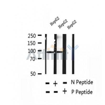 AF2438 at 1/100 staining Human thyroid cancer tissue by IHC-P. The sample was formaldehyde fixed and a heat mediated antigen retrieval step in citrate buffer was performed. The sample was then blocked and incubated with the antibody for 1.5 hours at 22¡ãC. An HRP conjugated goat anti-rabbit antibody was used as the secondary
