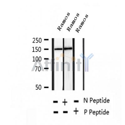 AF2442 at 1/100 staining Human thyroid cancer tissue by IHC-P. The sample was formaldehyde fixed and a heat mediated antigen retrieval step in citrate buffer was performed. The sample was then blocked and incubated with the antibody for 1.5 hours at 22¡ãC. An HRP conjugated goat anti-rabbit antibody was used as the secondary