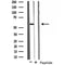 AF2737 at 1/100 staining Rat lung tissue by IHC-P. The sample was formaldehyde fixed and a heat mediated antigen retrieval step in citrate buffer was performed. The sample was then blocked and incubated with the antibody for 1.5 hours at 22¡ãC. An HRP conjugated goat anti-rabbit antibody was used as the secondary