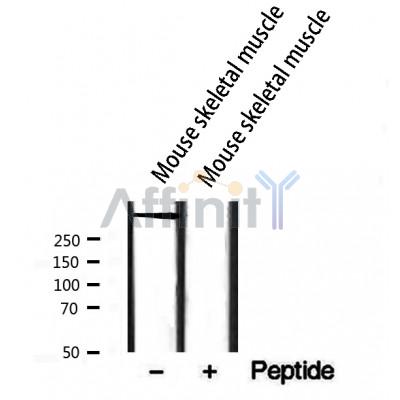 Western blot analysis of extracts from mouse skeletal muscle, using RYR2 Antibody.The lane on the right is treated with the antigen-specific peptide.