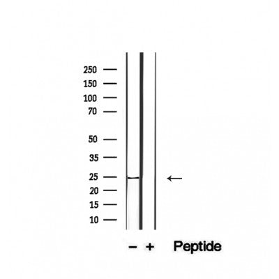 Western blot analysis of extracts from mouse spleen, using CD28 Antibody.The lane on the right is treated with the antigen-specific peptide.