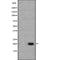 AF4005 at 1/100 staining Human thyroid cancer tissue by IHC-P. The sample was formaldehyde fixed and a heat mediated antigen retrieval step in citrate buffer was performed. The sample was then blocked and incubated with the antibody for 1.5 hours at 22¡ãC. An HRP conjugated goat anti-rabbit antibody was used as the secondary