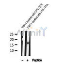 AF4006 staining HepG2 by IF/ICC. The sample were fixed with PFA and permeabilized in 0.1% Triton X-100,then blocked in 10% serum for 45 minutes at 25¡ãC. The primary antibody was diluted at 1/200 and incubated with the sample for 1 hour at 37¡ãC. An  Alexa Fluor 594 conjugated goat anti-rabbit IgG (H+L) Ab, diluted at 1/600, was used as the secondary antibod